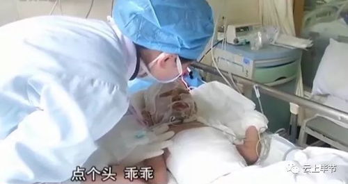 吃达美乐惨遭二度烧伤之痛