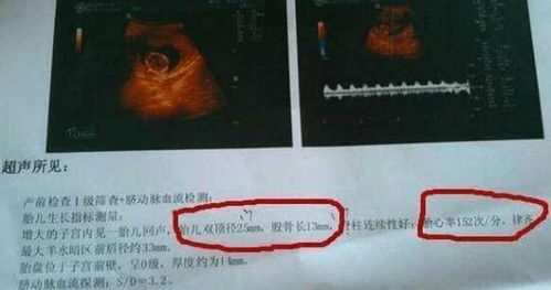 胎儿性别鉴定，科学与伦理的探讨