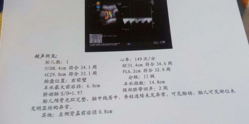 胎儿性别鉴定，科学与伦理的探讨