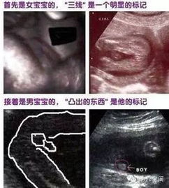 胎儿B超数据解读指南