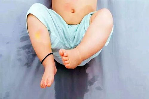 育儿专家视角下的女性健康，关于白带增多的全面解析与建议