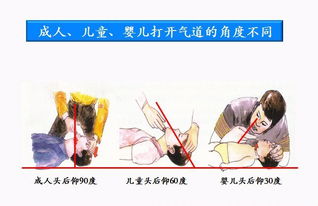一场意外，鲨鱼夹下的生命转折，女子摔倒后的植物人困境