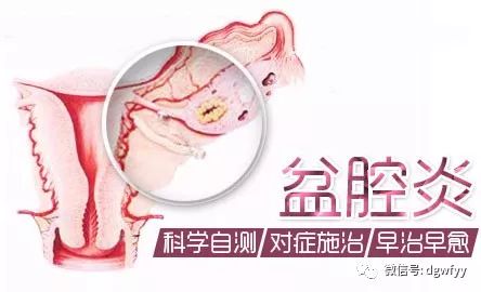 盆腔炎的治疗与预防，为女性健康护航