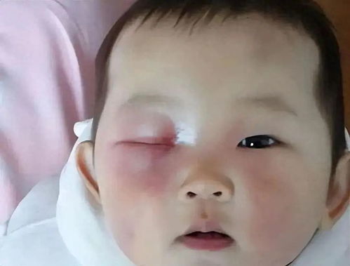 宝宝眼屎多，家长需关注的几个要点