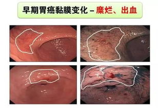 怀孕10天最明显的征兆——如何识别早期怀孕的微妙信号