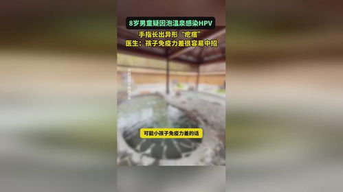 8岁男孩泡温泉手指感染HPV，一次意外引发的健康警示