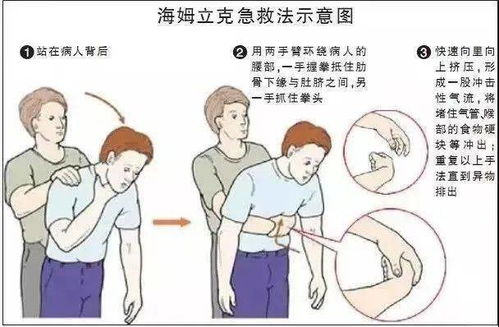 为宝宝健康成长，打胃管流食营养搭配全攻略