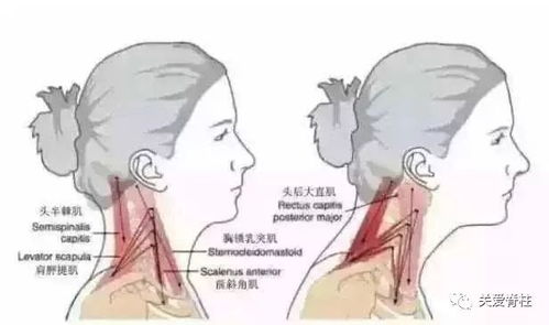 瑜伽学校：缓解焦虑、改善睡眠、告别颈椎痛的快乐选择