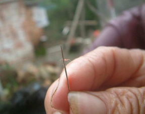 羊毛疔怎么治疗？快速缓解皮肤刺痒的实用方法