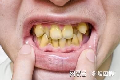 口腔医学技术：揭秘牙齿修复如何实现无痕美观与功能重建的完整指南