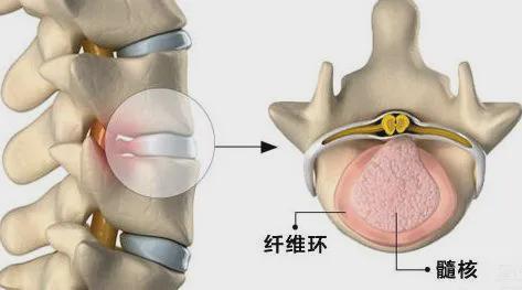 正骨推拿：轻松告别颈椎病、腰椎间盘突出，恢复骨骼健康无痛苦
