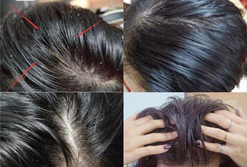 如何让头发长得快？这15个天然方法让发量暴增不再掉发